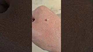 🙀🙀😱 Ladybug 🐞 Baby 🐥 Insect