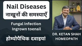 Nail Fungul infection onychomycosis Homeopathic permanent cure detail of medicines in Hindi Dr Ketan