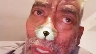 How many days on Jim tilmon zuran have you been told air particulate so to bed to run none