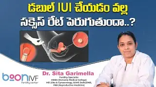 what is double IUI | Single IUI | uses | procedure |Success rate || Boon Fertility