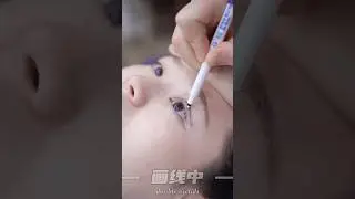 #typ #Tatcha #blepharoplasty #eyelidsurgery #aestheticeyes