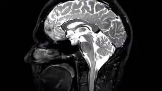 Sagittal T2 of the Brain (from Imaging Anatomy of the Human Brain)