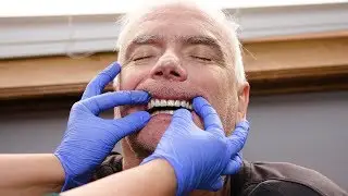 Smile Makeover In One Day!