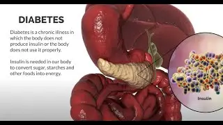 School Education, Lesson 3: Diabetes - Management of Classroom Emergencies