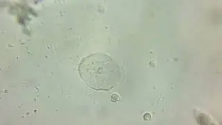 Uso del microscopio. Muestras al fresco