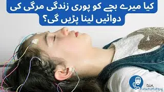 کیا میرے بچے کو پوری زندگی مرگی کی دوائیں لینا پڑیں گی؟