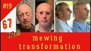 MEWING TRANSFORMATION AFTER 40!!! 💪🔥