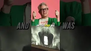 The Jackass Cast&rsquo;s Favorite Stunt Ever