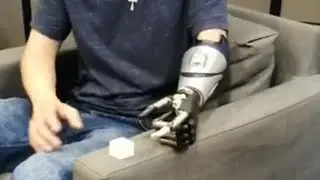 Kiedyś niemożliwe! Bioniczna proteza ręki, pierwsze ćwiczenia Bartka