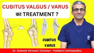 Cubitus Varus: कब ज़रूरी होती है Surgery? | Cubitus Valgus Difference | Dr. Somesh Virmani