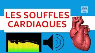 ❤ Souffle au coeur: écoutez les bruits cardiaques anormaux auscultation audio, cours cardiologie