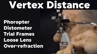 How to Measure Vertex Distance