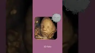 Pretecho Joy Heerlen 2D beeld naar 3D en 4HDlive foto