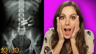 Top 10 UNBELIEVEABLE X-Rays