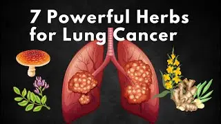 7 Powerful Herbs for Lung Cancer Support & Healing