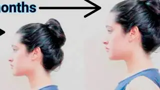 WOW ! How to Increase Height After 18, 21 or 25