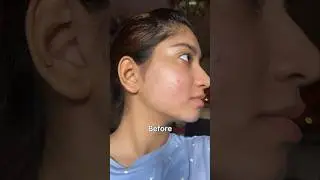 I tried Garnier Vitamin C Serum & this happened!!