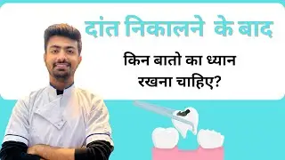 दांत  निकालने के बाद किन बातो का ध्यान रखना चाहिए ? | Post extraction instructions