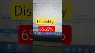 bera test for hearing disability persentage certificate