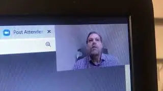 Botox side effects explained in neuroscience class.