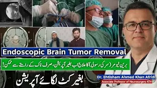 Endoscopic Brain Tumor RemovalPatient Shares His Experience After the Surgery
