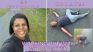 21 Fibroids Removed: Update