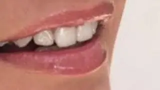 How to stop cold sores from happening
