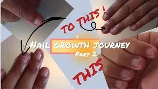 Nail growth Vlog 2 | Stopping Biting Nails for Good| Nail growth journey Update #vlog #nailgrowth