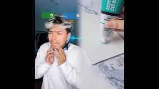 #pov  Todos lo molestan por ser feo hasta que eligi&oacute; ser bonito (Parte 1)