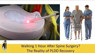 Spine Surgery Recovery: Walking in 60 Minutes? (PLDD vs. Microdiscectomy)