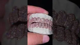 10 on 10 VVS Lab Diamond Grillz On 10K Rose Gold