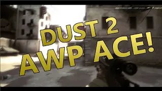 BEST PLAY! CSGO