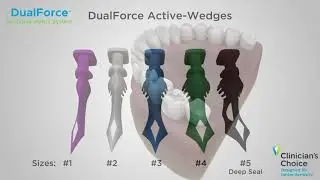 DUAL FORCE Sectional Matrix System Animation