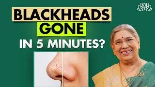 Remove Blackheads Permanently | This 3-Step Home Remedy Works | Dr Hansaji