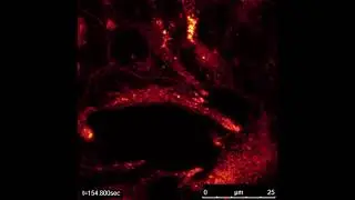 Multiphoton irradiation (800 nm) of HEK293T cells in the presence of quinolizinium photosensitizer