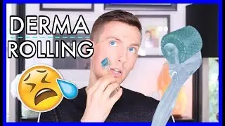 HOW TO USE A DERMA ROLLER x Remove Acne Scars, Dark Spots, Fine Lines & Wrinkles