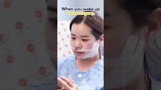 [Preview] Side Effects After Double Jaw Surgery? Korean Surgeon Explains! #shorts