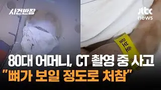 80대 어머니, CT 촬영 중 사고…