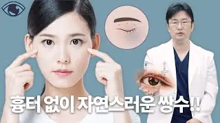 쌍수한 티 내기 싫다면.. 흉터 없이 자연스러운 '최소절개법'으로!!_[부산 케이엔젤성형외과]