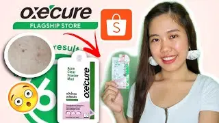 ОБЗОР ОЧИЩЕННОЙ ПУДРЫ ОТ АКНЕ OXECURE (Мгновенный результат за 6 часов) - Джона Бетт