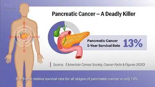 OkaiDx&trade; Pancreatic Cancer Early Detection: Clinical Study Results & Test Overview (PDAC)