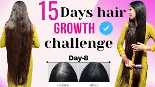 Day-8 |  15 days hair growth challenge | hair growth transformation अब आपके भी बाल होगे मजबूत #hair