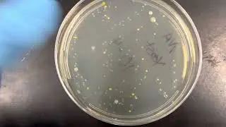 How to identify and count yeast colonies in dilution plates - Lab 4