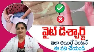 తెల్లబట్ట ఇలా ఉంటె | Normal & Abnormal White Discharge In Telugu | Vaginal Discharge Types | iDream