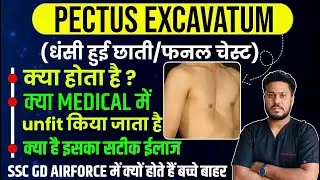 What is pectus excavatum/pectus excavatum treatment/funnel chest/pectus excavatum treatment