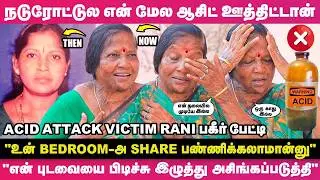 'உன் Bedroom-அ Share பண்ணிக்க வரட்டுமா?'ன்னு&nbsp;தொந்தரவு பண்ணுவாங்க🙄- Acid Attack Victim Rani உருக்கம்😰