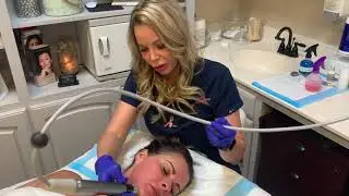 Genius RF Microneedling for the Neck