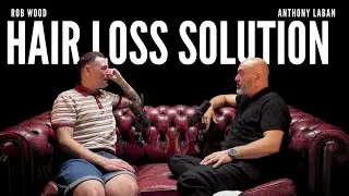 How To Fix Hair Loss, Mens Hair Extension & How To Consult | Rob Wood | EP.41
