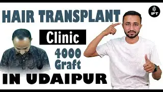 💯 Hair Transplant Clinic in Udaipur &ndash; Get Perfect Hair NOW! 😍