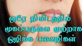 Acne | pimples | mugapparu | facial | home remedies | Ayurvedic | pimple solutions | acne problems